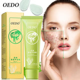 Seaweed Aloe Vera Gel Hydrating Whitening Day Creams Acne