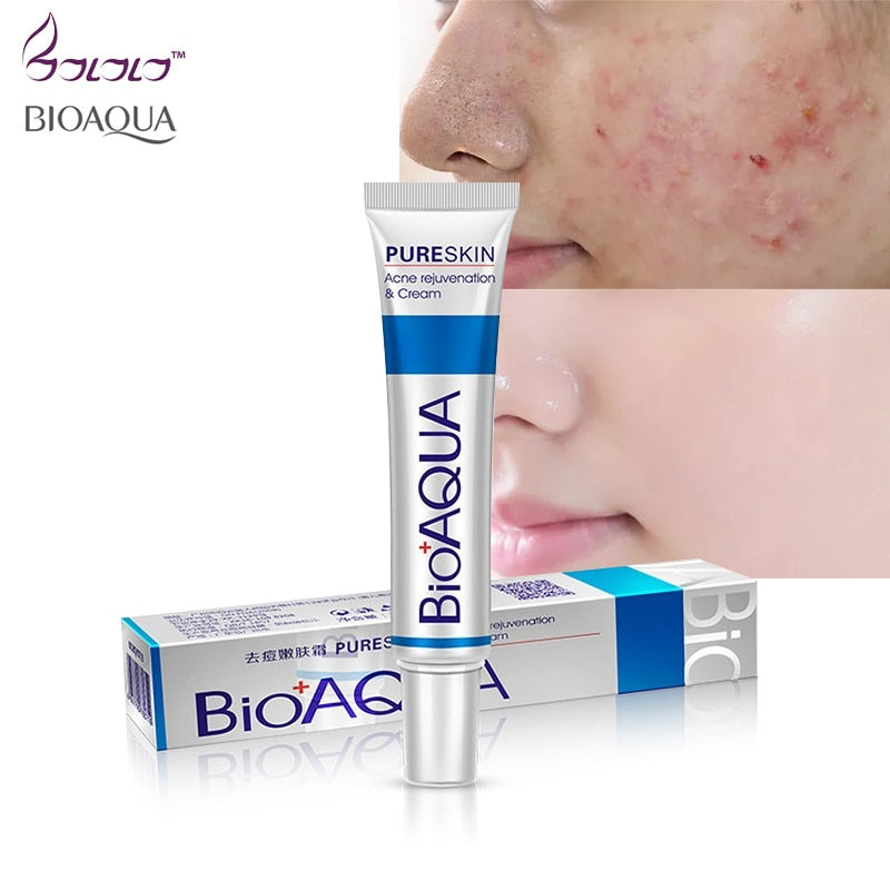 New face cream whitening skin care anti acne treatment