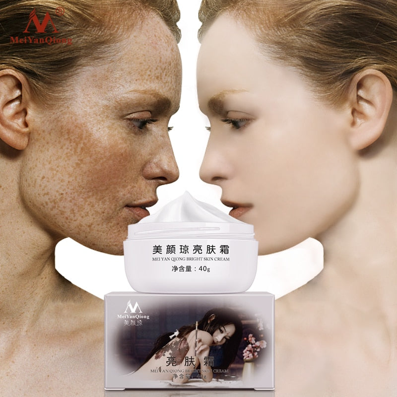 Meiyanqiong Anti Aging Face Care Cream Dark Spot Remover